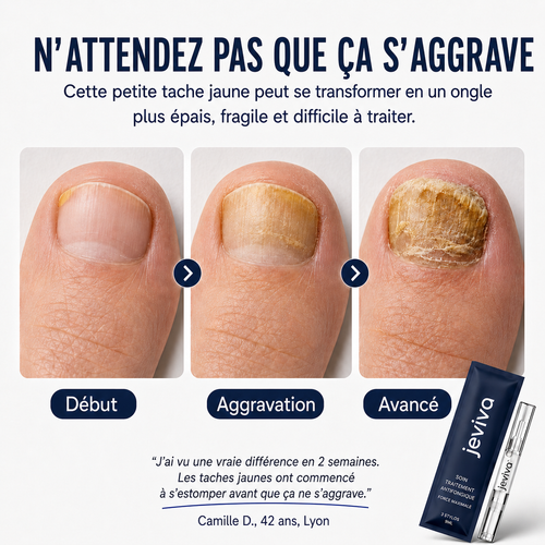Jeviva™ Stylo Antifongique pour Ongles – 25% Acide Undécylénique